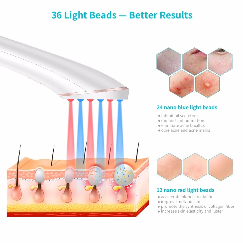 Xpreen Wireless Rechargeable Acne Light Therapy Device – Blue & Red Light Acne Treatment & Clearing Eraser