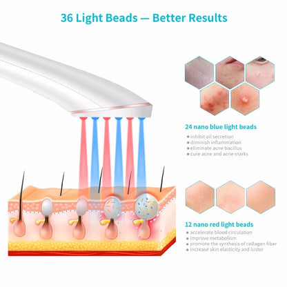 Xpreen Wireless Rechargeable Acne Light Therapy Device – Blue & Red Light Acne Treatment & Clearing Eraser